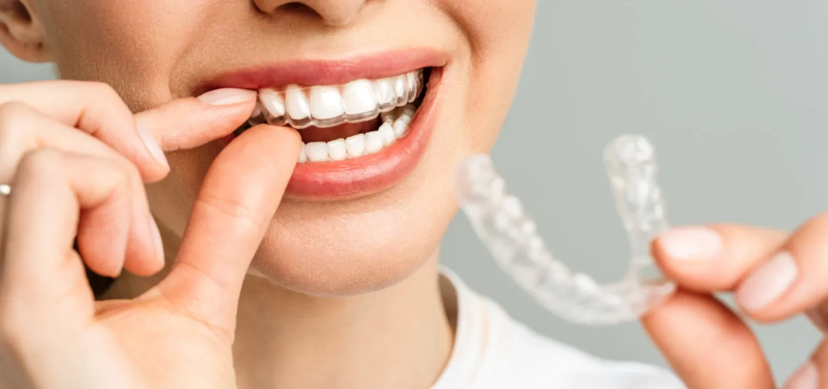 Orthodontiste adultes Bagnères-de-Bigorre