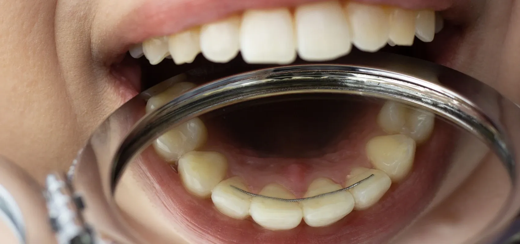 Orthodontiste Bagnères-de-Bigorre